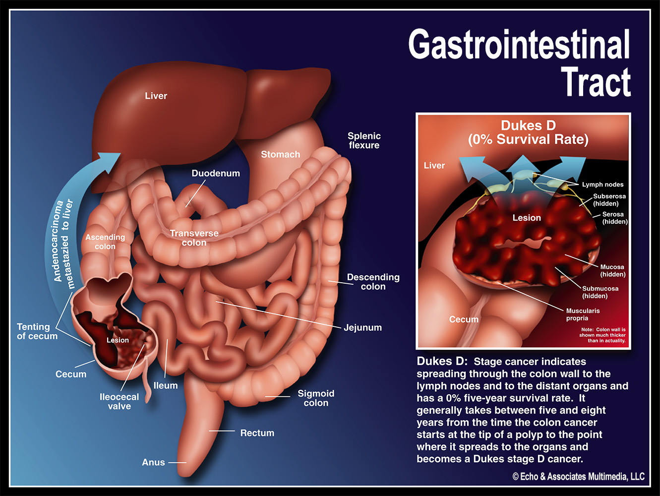GI Tract Medical Diagram